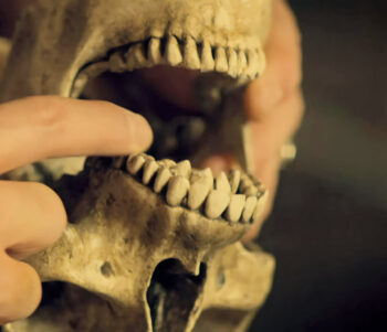 The skull of Clootie's son with unusual dentition. - Wynonna Earp 107